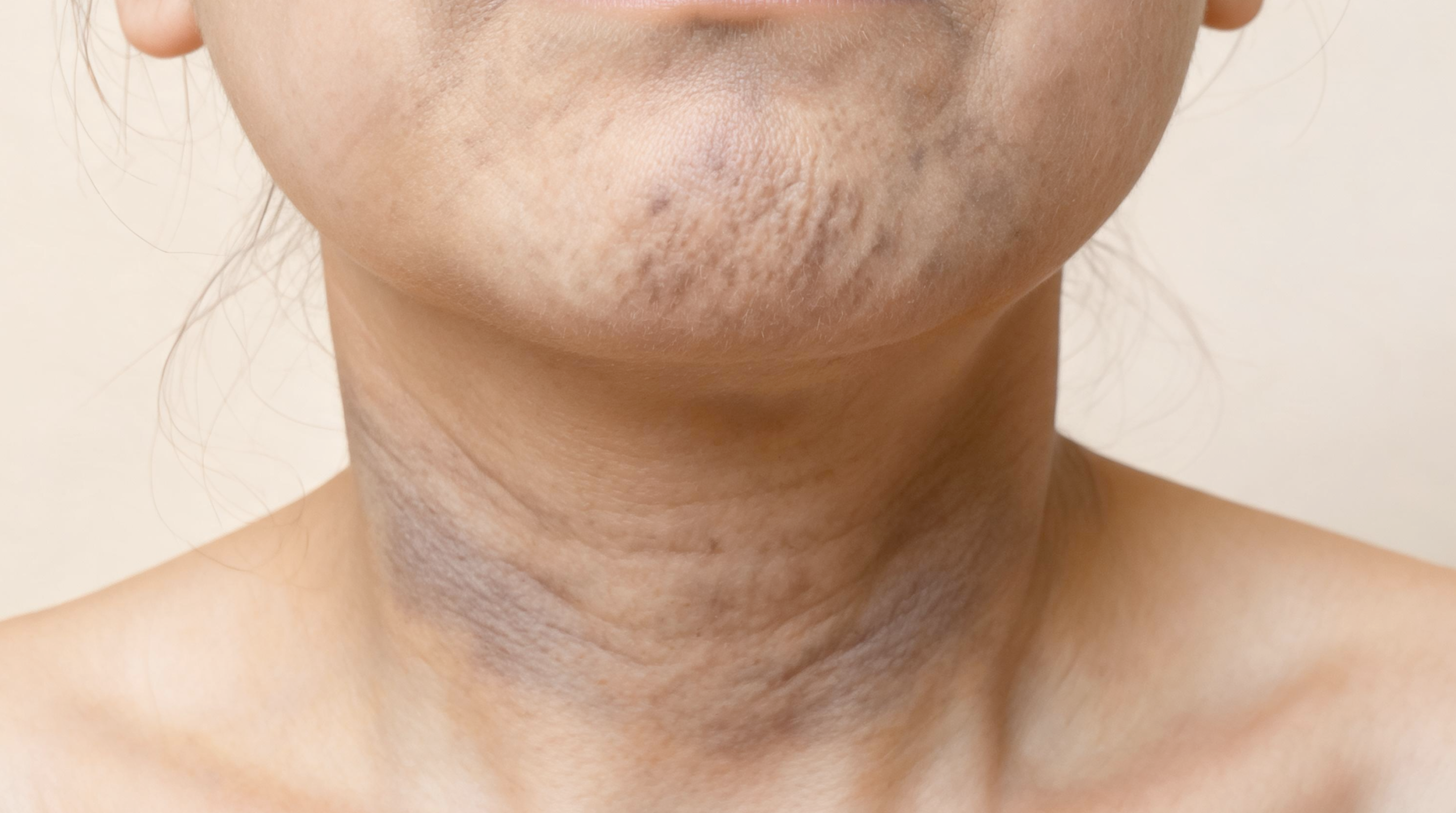 Before and after wipe showing clearer-looking skin tone